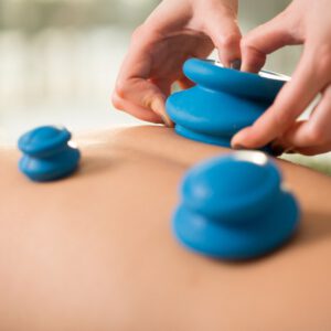 Cupping Therapy