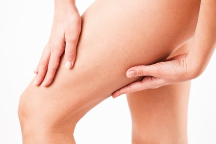 Anti Cellulite Massage Nottingham